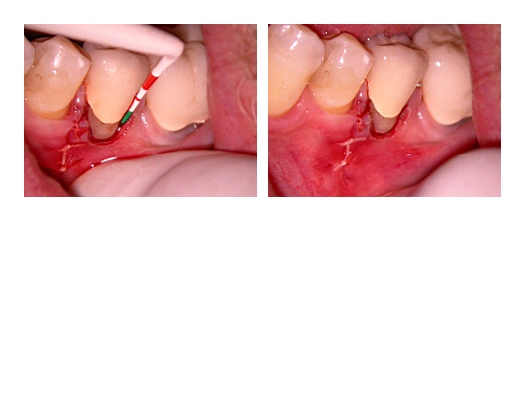 root resorption_Page5.jpg